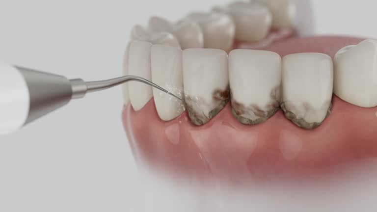 Trusted Wisdom Tooth Removal service in North Crossett, AR - Dentist Open Now